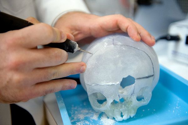 3D Printed Skull - Image